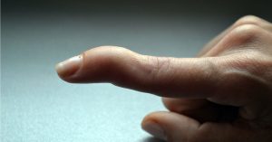 Çekiç Parmak Ameliyatı